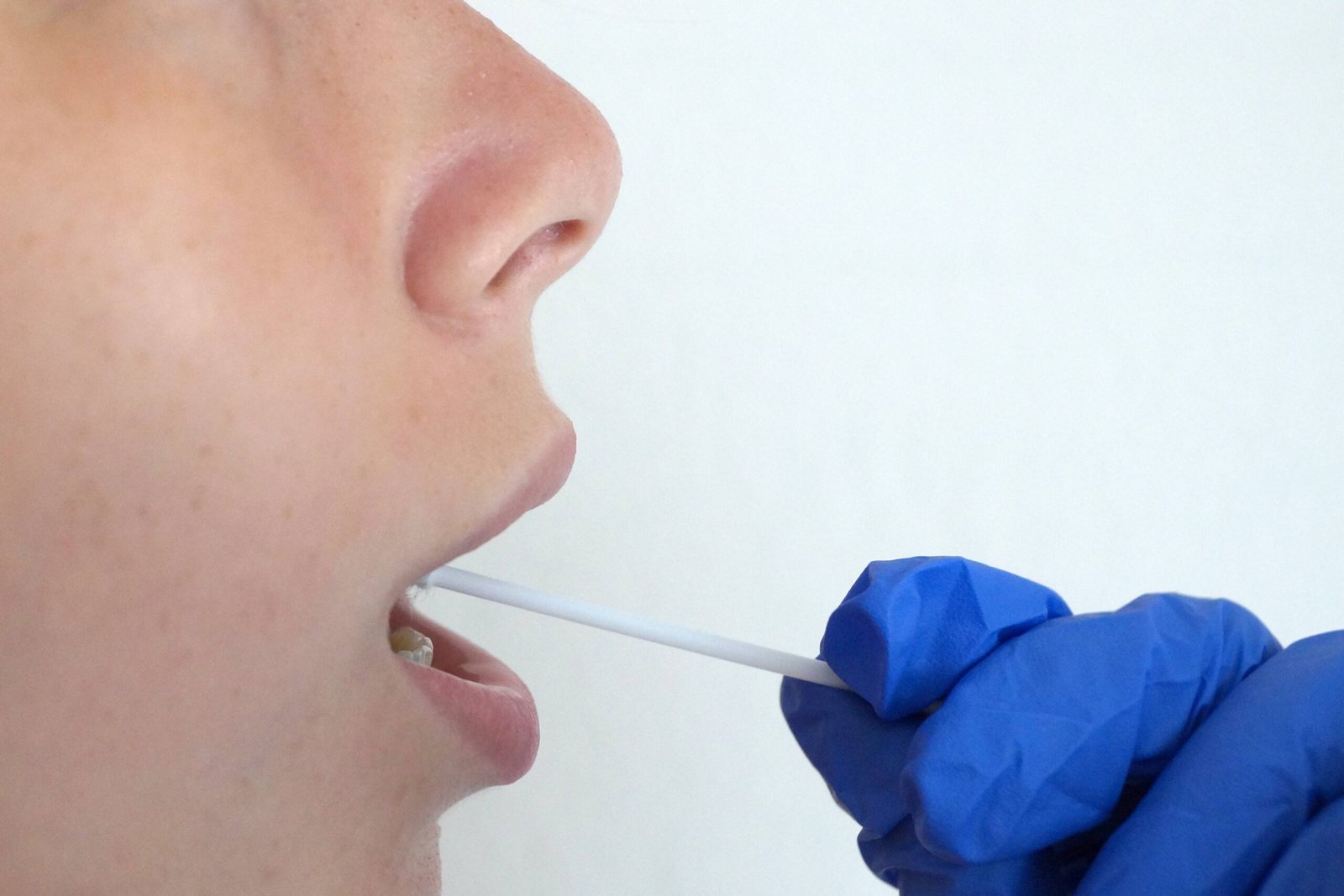 Urine Test